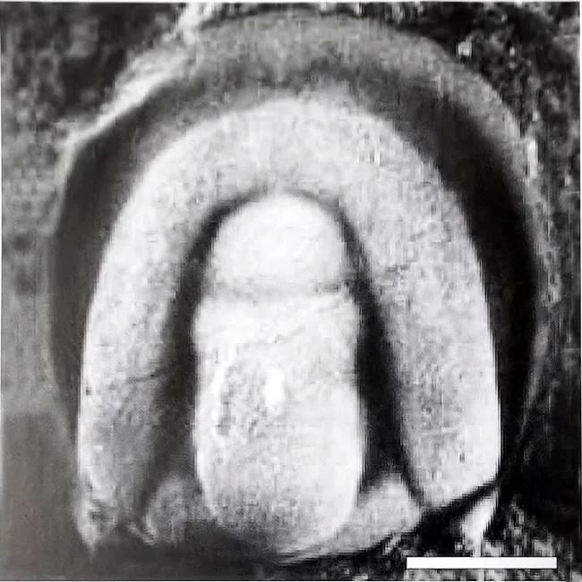 Ammagnostus wangcunensis