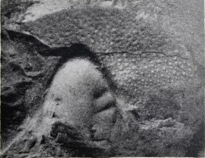 Archikainella vomerinus