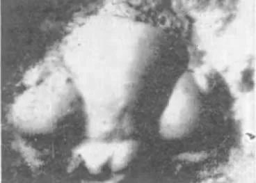 Corynexochus plumula