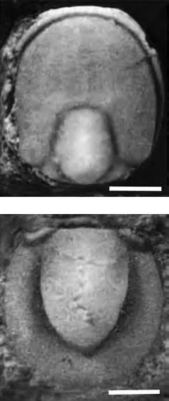 Lisogoragnostus hybus