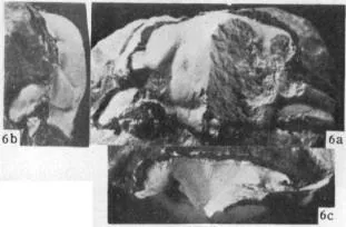 Palaeadotes hunanensis