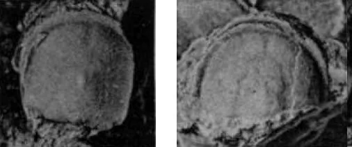Pseudagnostus prolongus