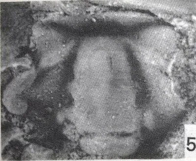 Teinistion typicalis
