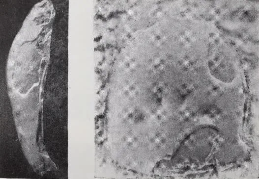 Xenocyclopyge radiata